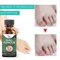 Nail Fungus Treatment Serum 10ml