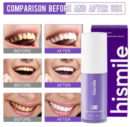 HiSmile Serum for Teeth Whitening
